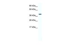 FoxF1 Antibody, Novus Biologicals 100 &mu;L; Unconjugated:Antibodies, Polyclonal